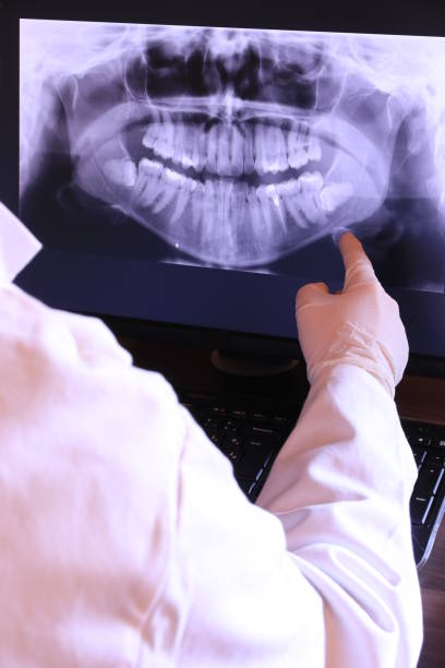 Best Broken or Chipped Tooth Repair in Provo, UT