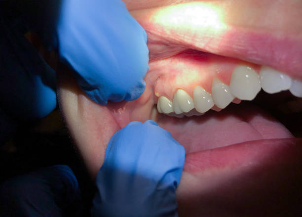 Best Emergency Treatment for Jaw Pain or Injury in Provo, UT