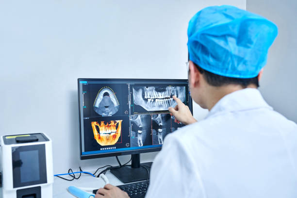 Best Knocked-Out Tooth (Avulsed Tooth) Treatment in Provo, UT